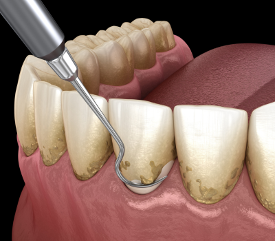 Children's Dentistry