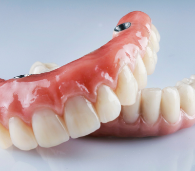 Dental Bridge Types