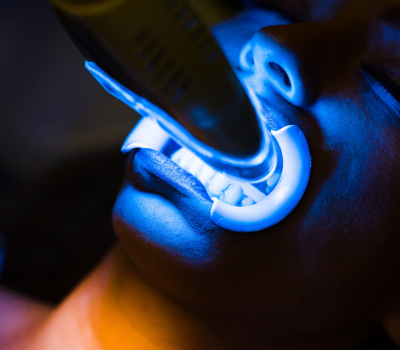 Laser Gum Surgery